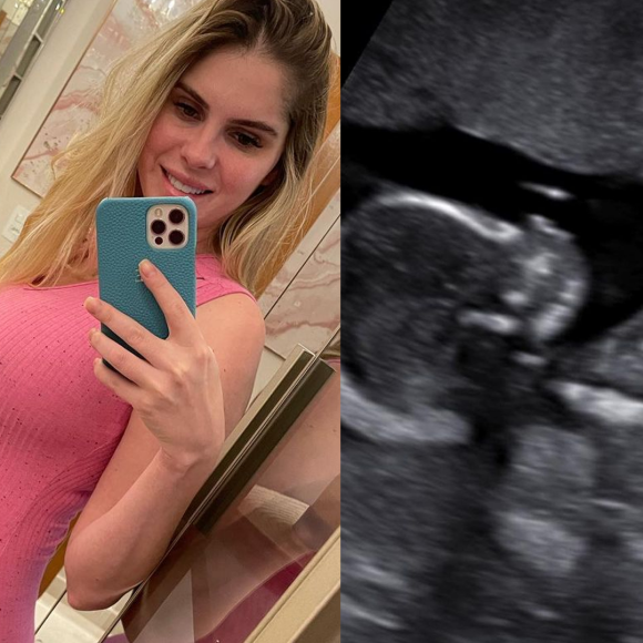 Bárbara Evans compartilhou fotos da ultrassom com os seguidores