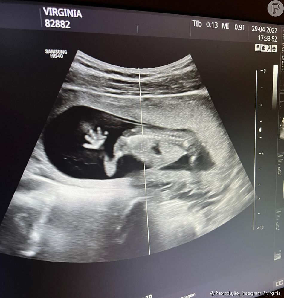 Virgínia Fonseca mostra ultrassom de segunda gestação