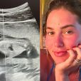 Virgínia Fonseca mostrou uma ultrassonografia de sua segunda gravidez