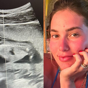 Virgínia Fonseca mostrou uma ultrassonografia de sua segunda gravidez