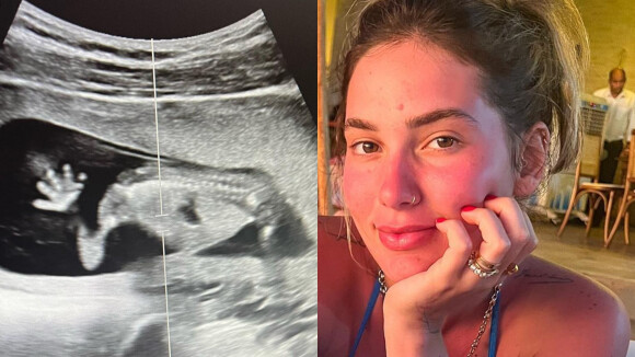 Grávida, Virgínia Fonseca mostra ultrassom do bebê e detalhe rouba a cena. Veja foto!