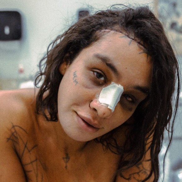 Linn da Quebrada diminuiu o tamanho da testa