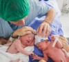 Os bebês nasceram por meio de um partocesariana na maternidade Pro Matre, em São Paulo