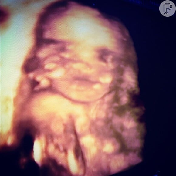 Fernando Scherer, o Xuxa, mostra imagem de Brenda em exame de ultrassonografia