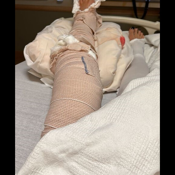 Luciana Gimenez está internada em hospital dos EUA após acidente na neve