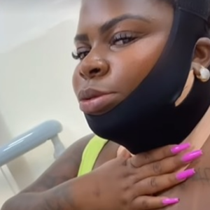 Jojo Todynho também realizou uma lipoaspiração na 'papada' na última semana