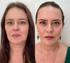 O antes e depois de Mariana Bridi impressiona