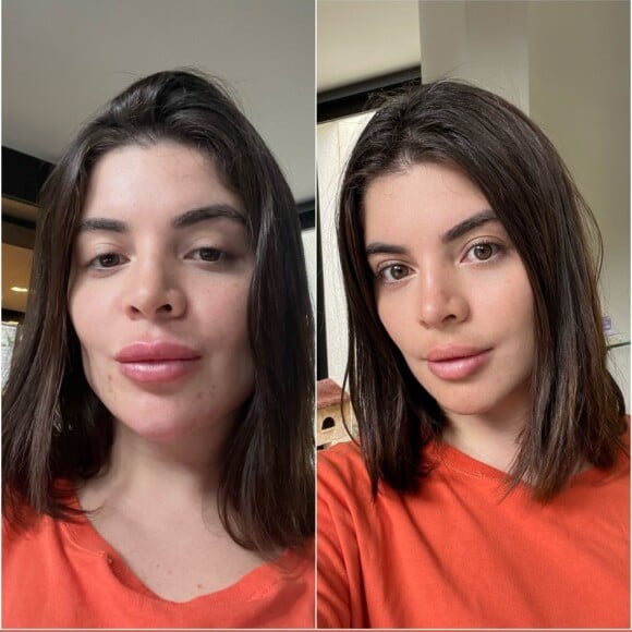 Gkay retirou alguns procedimentos estéticos