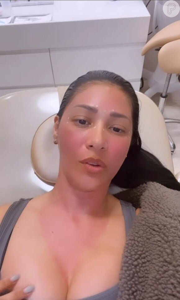 Simaria fez laser no rosto e colo e aplicação de botox