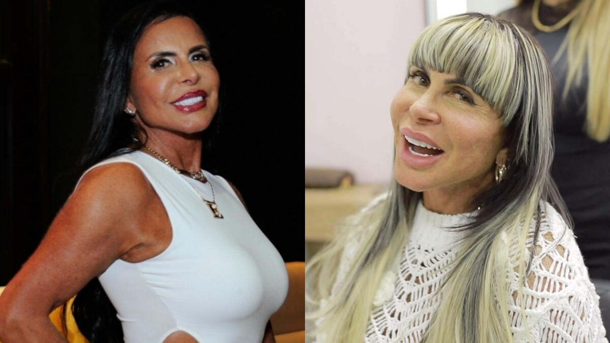 Foto Antes E Depois De Gretchen Purepeople 8787