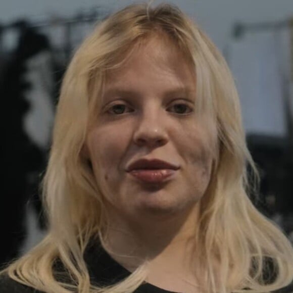No papo com Blogueirinha, a artista falou sobre o documentário "Se Eu Fosse Luísa Sonza". Com estreia na Netflix no dia 13 de dezembro de 2023, a série íntima mostra vida amorosa e carreira da cantora pop cercada de polêmicas. O cabelo foi uma questão marcante para Luísa ao assistir edições do doc