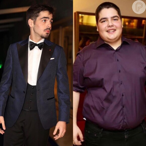 João Guilherme Silva, filho do Faustão, realizou a bariátrica em 2020, pesando 140 kg