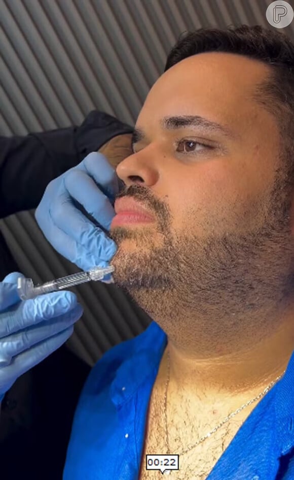 Ex-BBB Michel faz harmonização facial com cirurgião-dentista Domingos Mantelli
