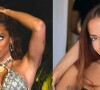 Anitta sem maquiagem: cantora já revelou ter feito muitas plásticas no rosto