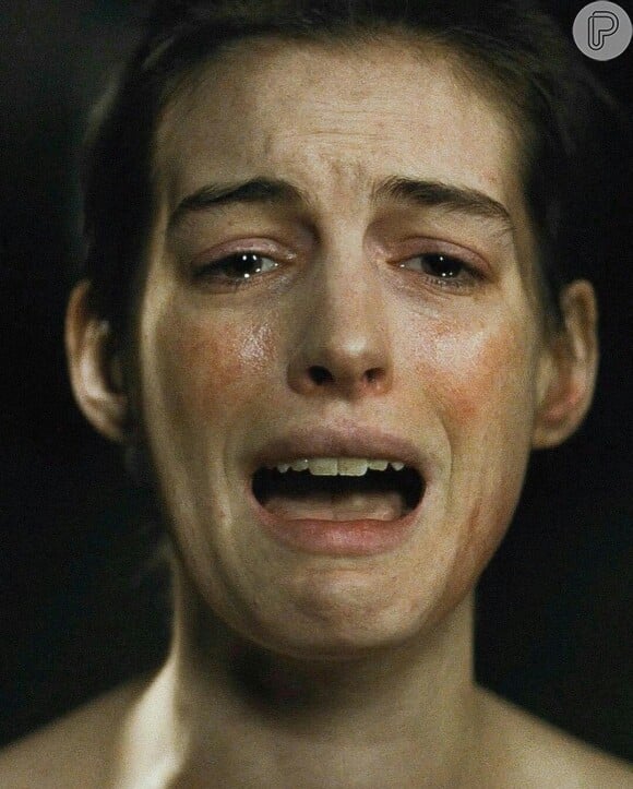 Anne Hathaway chegou a emagrecer 11 quilos em apenas 15 dias e ficou muito doente depois do filme