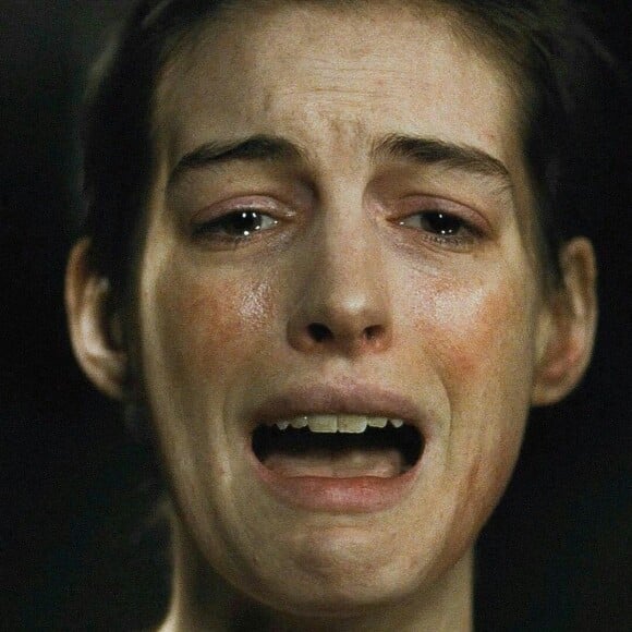 Anne Hathaway chegou a emagrecer 11 quilos em apenas 15 dias e ficou muito doente depois do filme