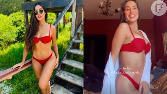 Antes e depois de Deniziane impressiona: ex-BBB turbinou seios com 360 ml de silicone e os exibiu em um biquíni vermelho