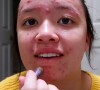 Jornada de mudanças de Alivia D'Andrea começou quando ela ainda tinha 17 anos, com o tratamento de acnes e tentativas de emagrecimento