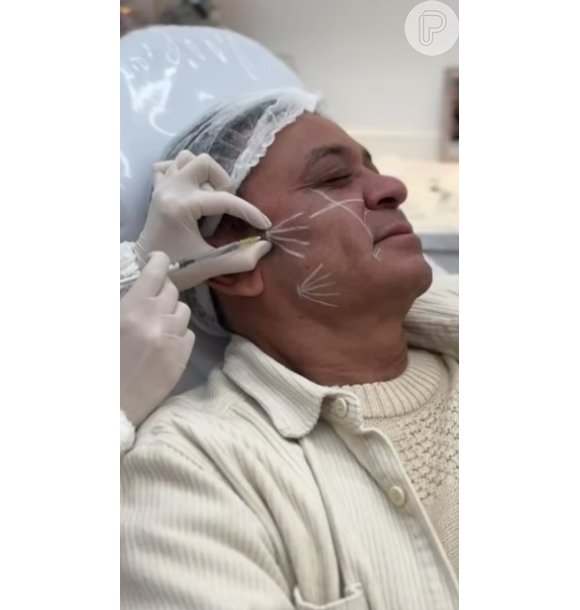 Agora, Frank Aguiar resolveu retocar seus procedimentos para melhorar a qualidade da pele