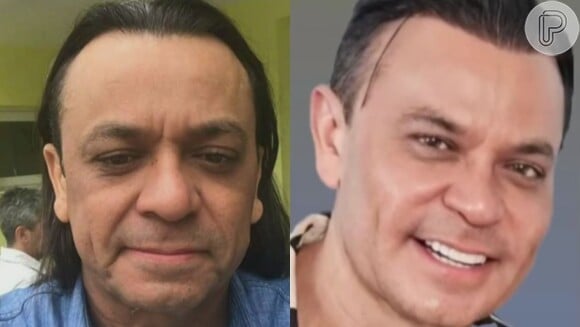 Frank Aguiar também mostrou em fotos o seu antes e depois, deixando muita gente impressionada