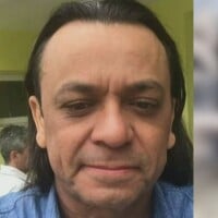 '53 com carinha de 33': Frank Aguiar passa por nova harmonização facial e surpreende fãs com antes e depois. Veja o resultado!