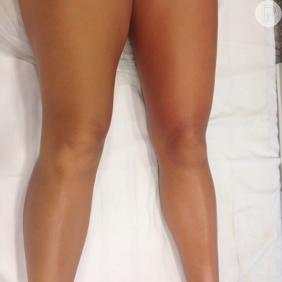 Fernanda Souza também exibiu as pernas reluzentes após uma drenagem linfática