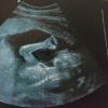 Heloisy Oliveira, a namorada de Micael Borges, publicou a foto de uma ultrassonografia. 'Meu bebê cada dia maior!'