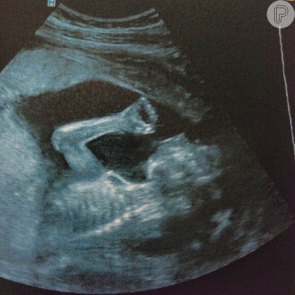 Heloisy Oliveira, a namorada de Micael Borges, publicou a foto de uma ultrassonografia. 'Meu bebê cada dia maior!'