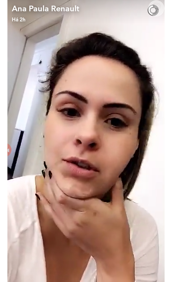 Ex-BBB Ana Paula Renault publicou um vídeo na sua conta no Snapchat em cantando o dentista, nesta quarta-feira, 20 de julho de 2016