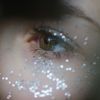 Foliões devem tomar cuidado com o glitter próximo a área dos olhos já que particulas podem causar pequenos danos às córneas