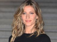 O que fazem os peelings feitos por Gisele Bündchen, Megan Fox e outras famosas?