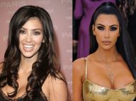 Harmonização orofacial: o procedimento que mudou os traços de Kim Kardashian