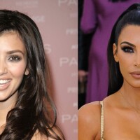 Harmonização orofacial: o procedimento que mudou os traços de Kim Kardashian