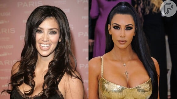 Harmonização orofacial: Kim Kardashian mudou muito com vários procedimentos de 2006 até 2019