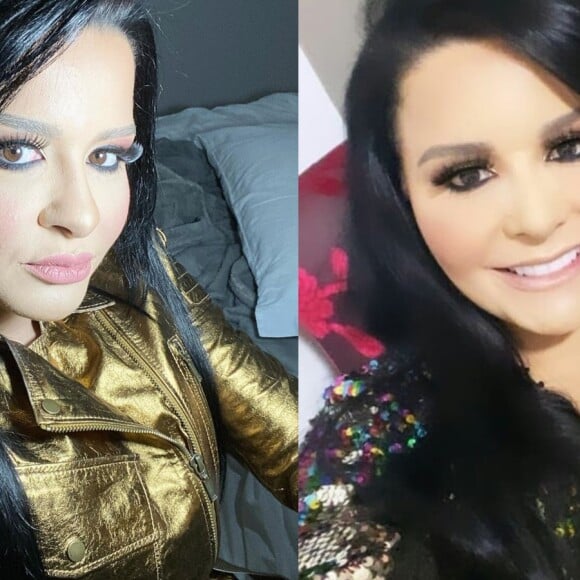 Veja antes e depois de plástica no nariz de Maraisa!