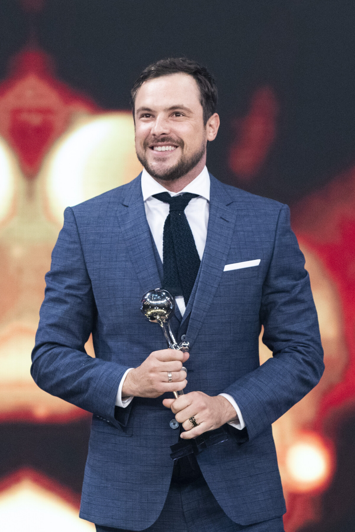 Foto Sergio Guizé recorreu ao transplante capilar Purepeople