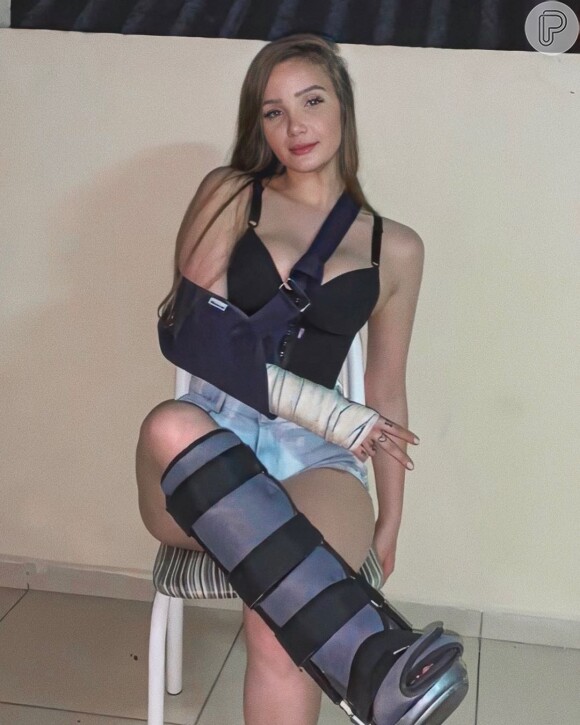 Anna Livya Padilha acalmou fãs após acidente de carro. Ao Purepeople, mãe da atriz diz que filha deve tirar tipoia e bota ortopédica ainda nesta semana