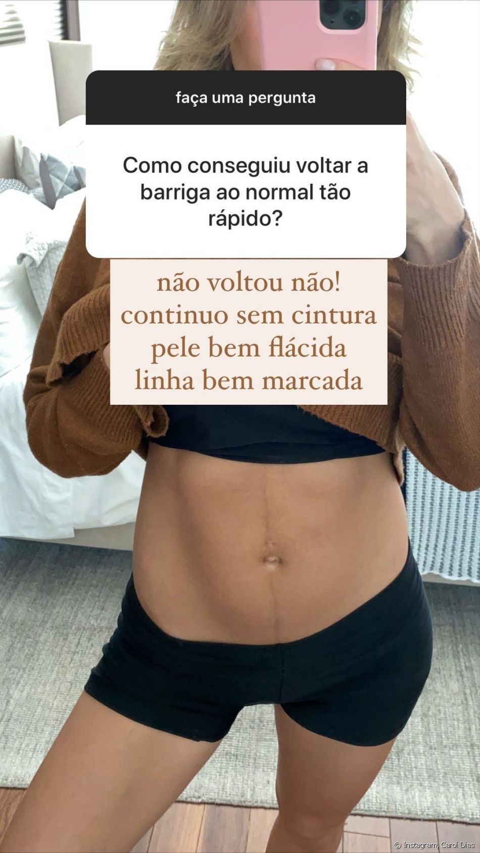 Corpo pós-parto de Carol Dias: mulher de Kaká mostra barriga em foto