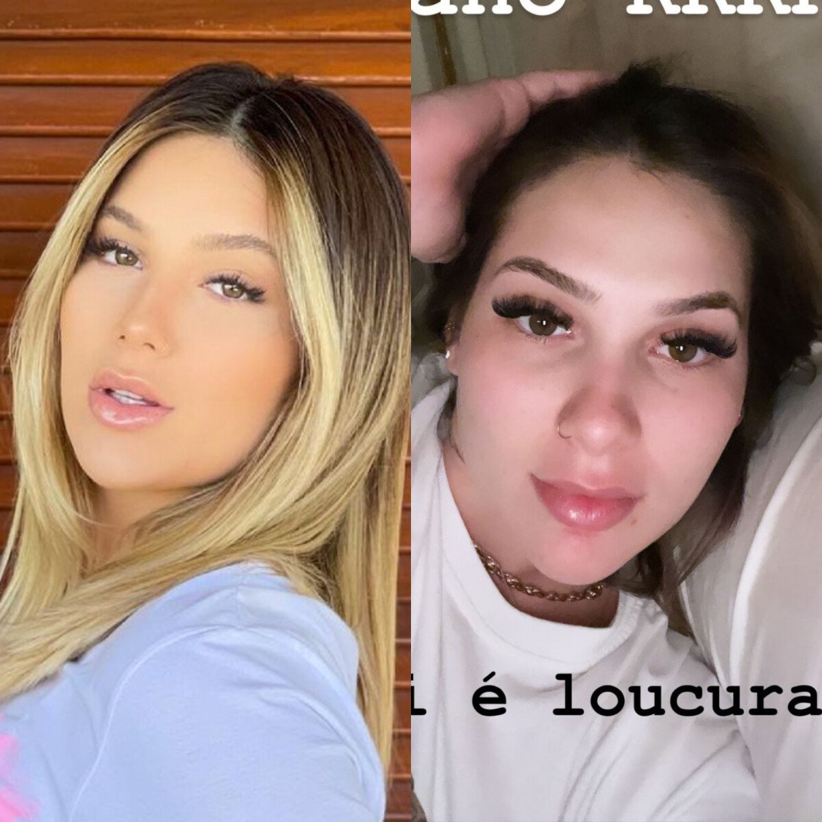 Foto: O Antes E Depois Do Nariz De Virgínia Fonseca, Inchado Nesta Reta ...