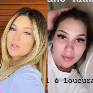 O antes e depois do nariz de Virgínia Fonseca, inchado nesta reta final da gravidez