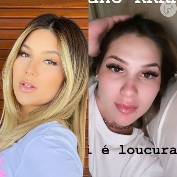 O antes e depois do nariz de Virgínia Fonseca, inchado nesta reta final da gravidez
