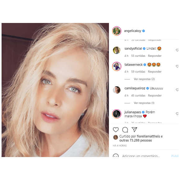 Angélica posta selfie 'descabelada' e beleza encanta Sandy e mais famosas: 'Maravilhosa'