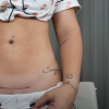 Virgínia mostra cicatriz da cesariana para os seguidores e explica que marca só teve pontos internos