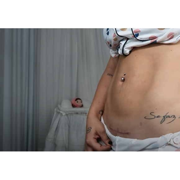 Virgínia também tentou mostrar a cicatriz de lado para evidenciar que não havia muito alto relevo