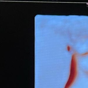 A foto foi tirada de um ultrassom da menina