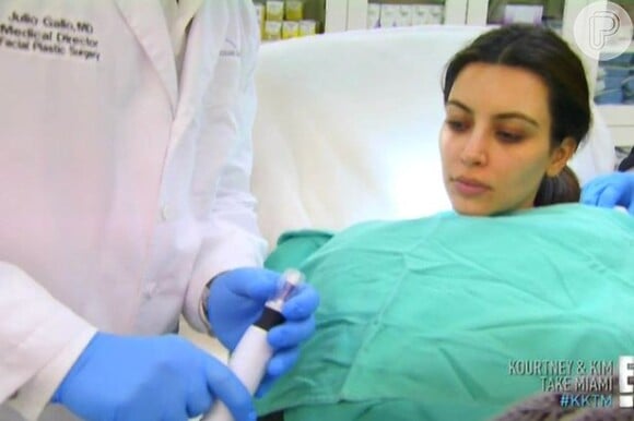Antes do procedimento, Kim Kardashian passou uma pomada anestésica para amenizar a dor, o que não adiantou muito