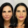 'A Fazenda 13': antes e depois de Solange Gomes, ao passar por harmonização facial