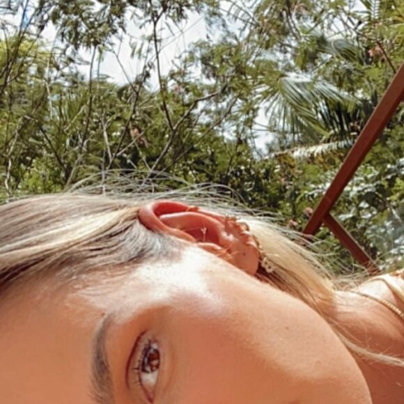 Yasmin Brunet contou aos seguidores que fez botox: 'Bem leve para ficar forever 20. 33 aninhos né'