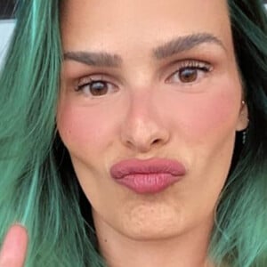 Yasmin Brunet revelou aos seguidores no Instagram que faz botox 'bem leve'