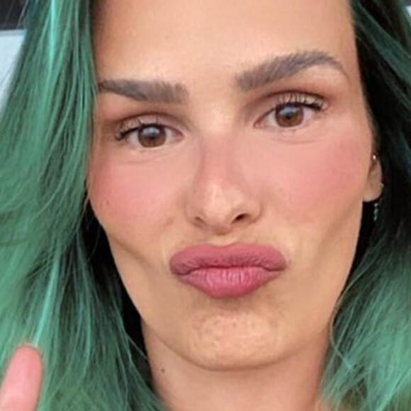 Yasmin Brunet revelou aos seguidores no Instagram que faz botox 'bem leve'